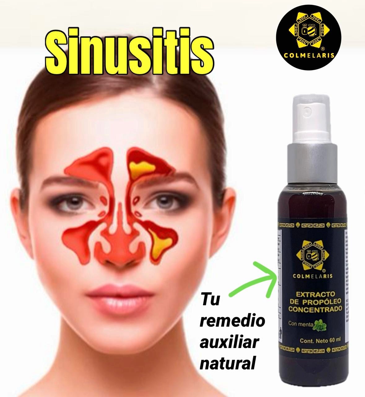sinusitis